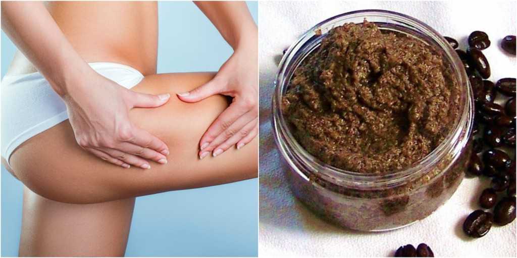 Что делать с дряблой кожей после похудения? ✔️ блог клиники лица