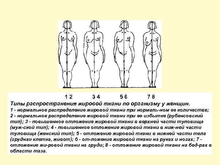 Сколько откладывается жир. Типы ожирения по типу распределения жировой ткани. Андроидный Тип распределения жировой ткани. Распределение жировой ткани по женскому типу. Типы ожирения по распределению жировой ткани.