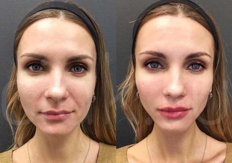 Инновационная сыворотка Super Potent Eye Serum – первое средство против усталости и старения, которое заметно улучшает всю область вокруг глаз