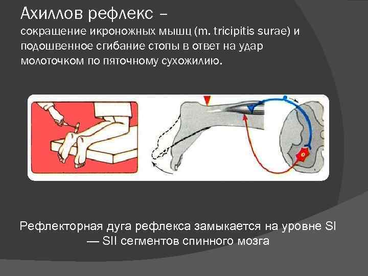 В изображенном на рисунке опыте экспериментатор ударяет неврологическим молоточком