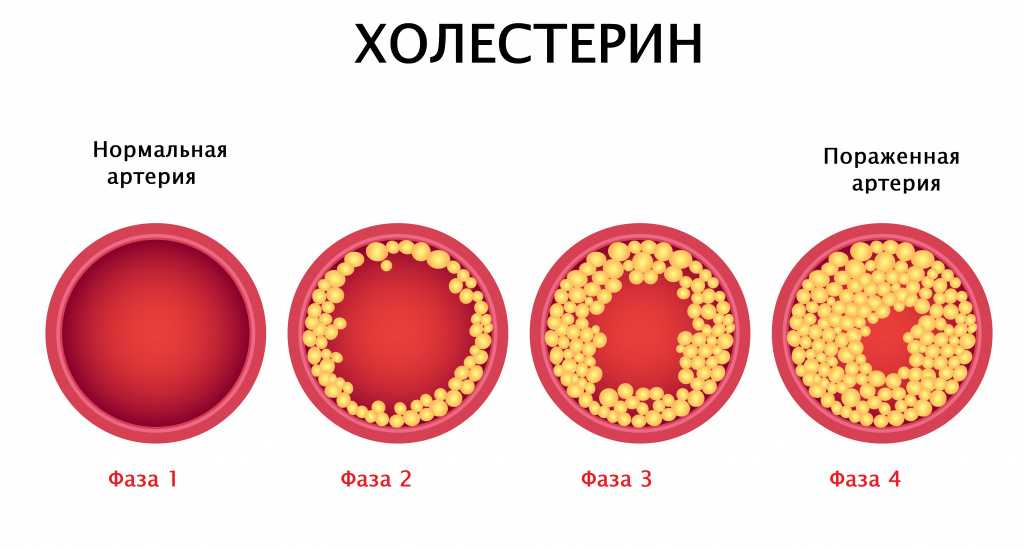 Холестерин: нормальный, низкий и высокий — нормы для взрослых и детей | университетская клиника