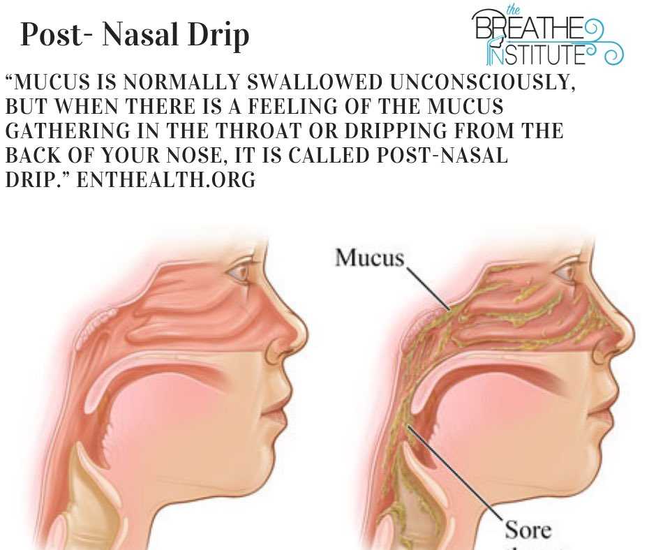 Почему течет вода из носа без простуды. Постринальный синдром. Синдром постназального затекания.