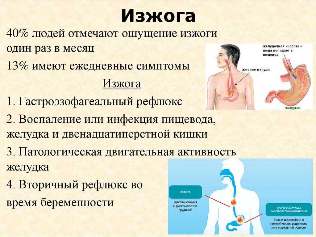 Всего 20-30 лет назад творог при изжоге считался одним из лучших средств для борьбы с неприятными ощущениями Однако сегодня кисломолочный продукт и сам может стать причиной проблем с ЖКТ Творог при изжоге может избавить от неприятных ощущений Общая информ