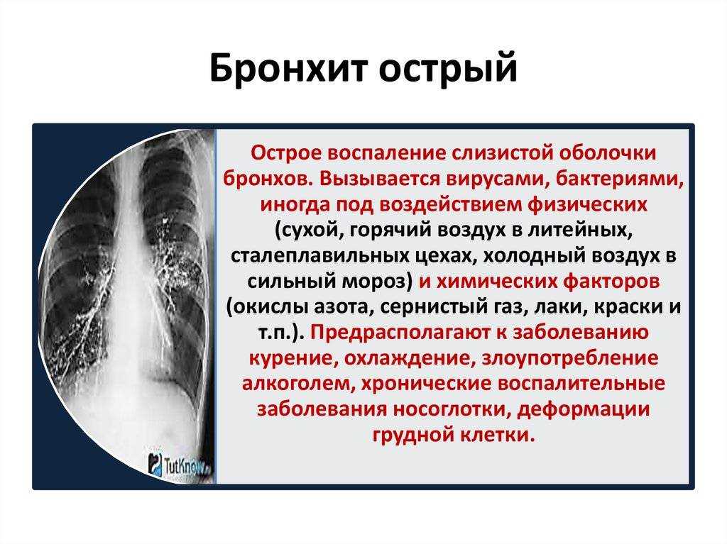 Разрушаются ли коленные суставы при беге? - новости медицины