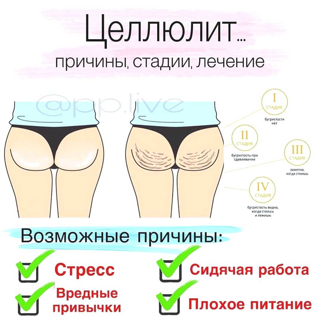 Самые эффективные салонные процедуры от целлюлита ✔️ блог клиники лица