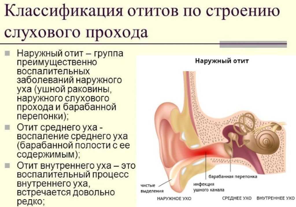 Наружный отит карта вызова