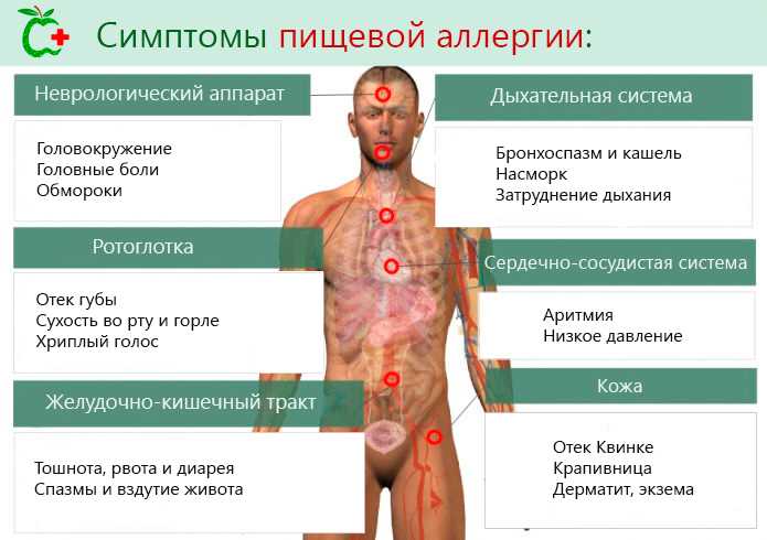 Аллергия - причины, симптомы и виды аллергии, анализ на аллергию