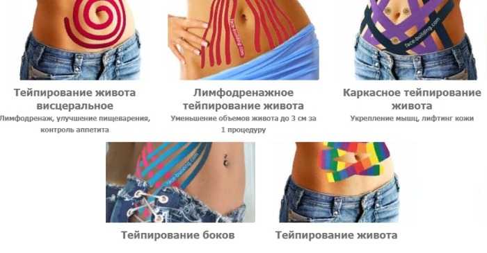 Тейпы на живот после родов схема