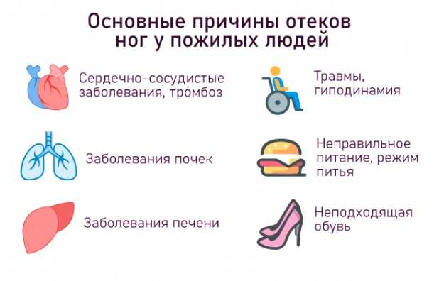 Профилактика остеопороза