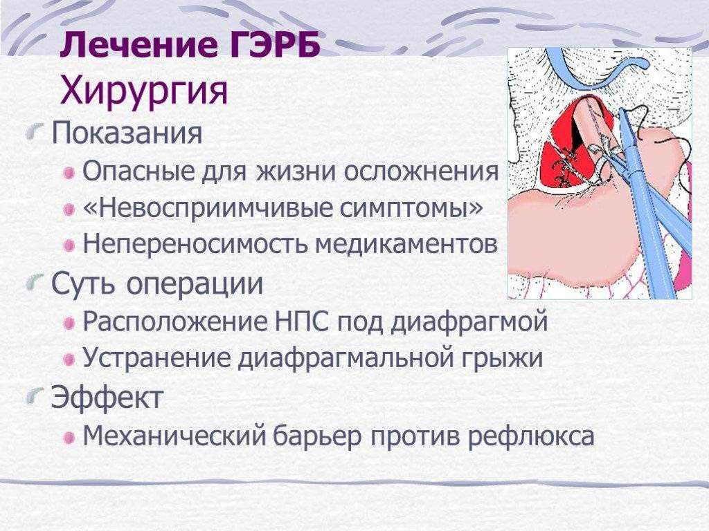 Помогает ли мед при изжоге | народная медицина