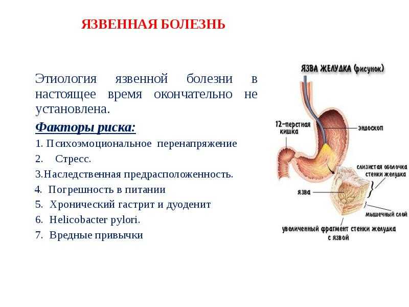 Алоэ с медом от кашля: лучшие рецепты для взрослых и детей, противопоказания