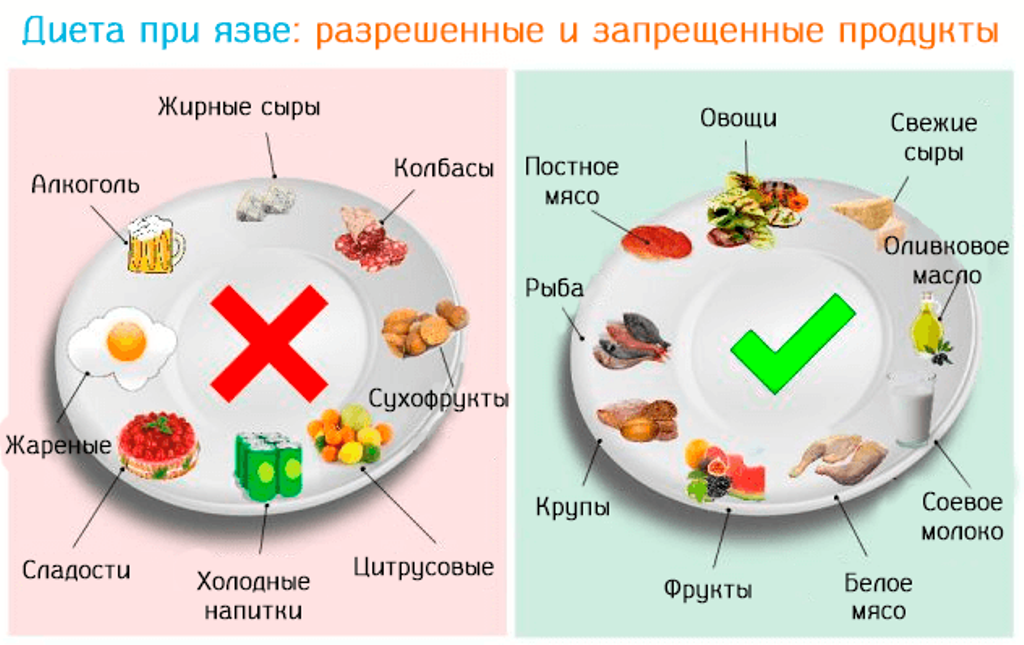 Диета при язве желудка и двенадцатиперстной кишки в период обострения супы