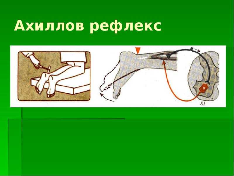 Схема рефлекторной дуги ахиллова рефлекса с обозначениями