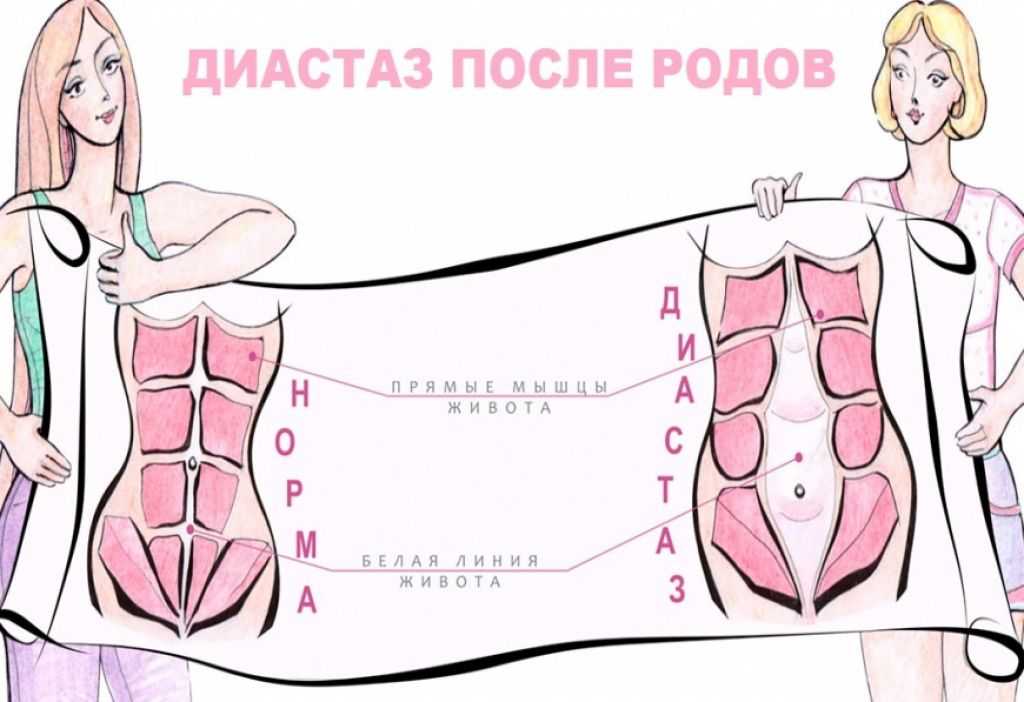 Стрессовый живот: его причина и как с ним бороться