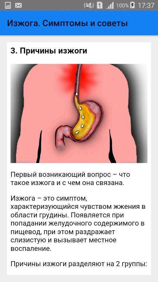 Изжога у детей - причины, диагностика, методы лечения, осложнения и профилактика | см-клиника