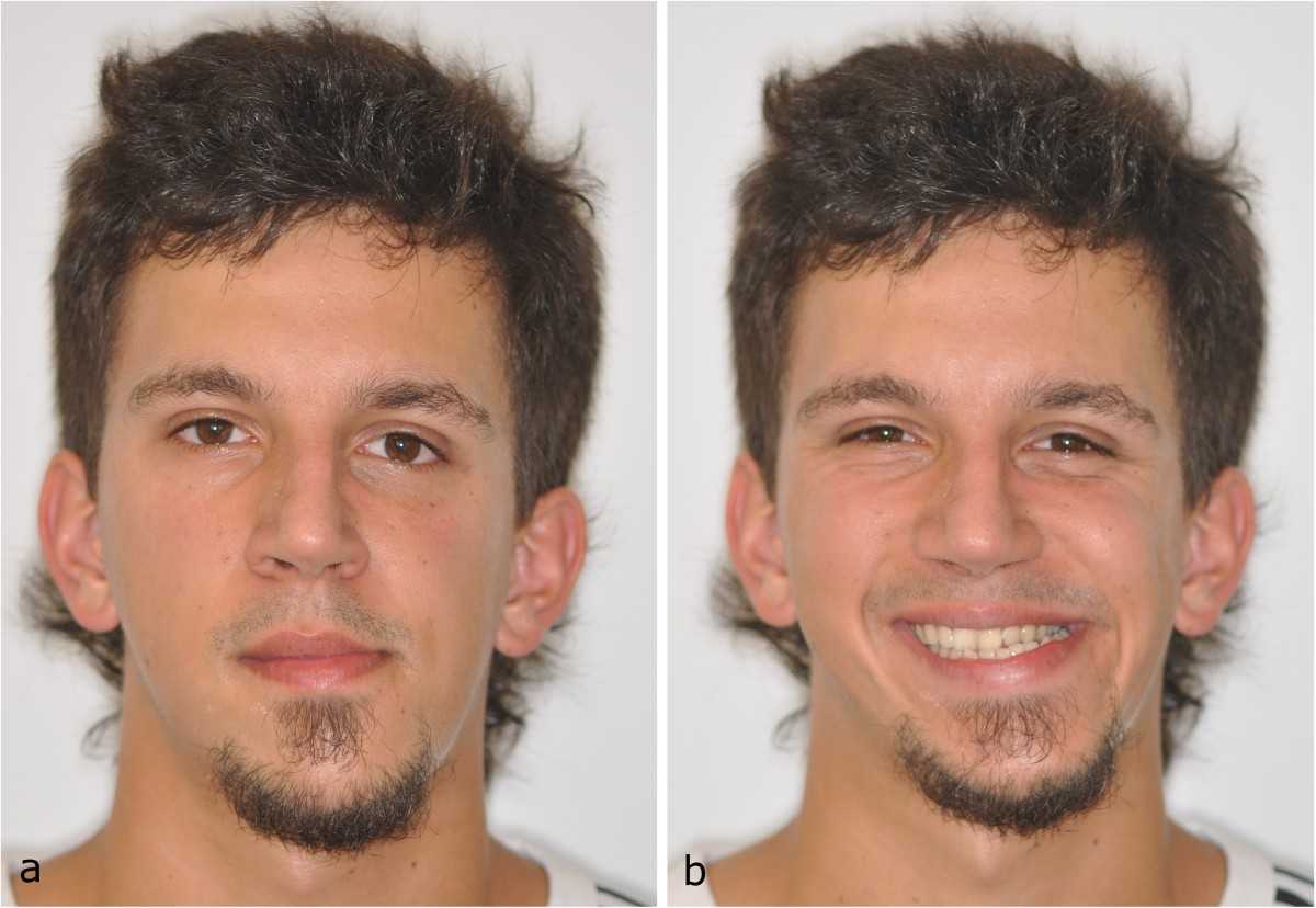 Оценка внешности по фото для мужчин