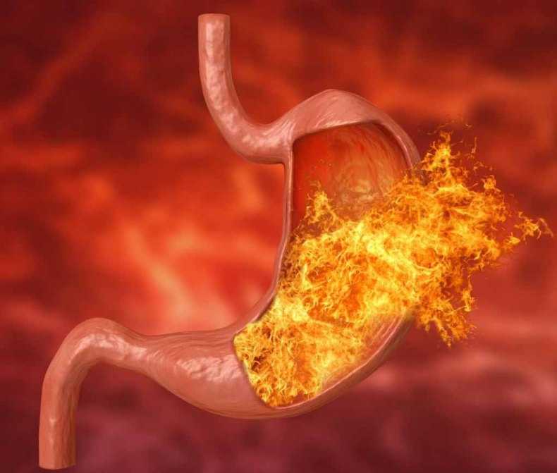 Привкус кислого во рту: причины, лечение неприятного симптома | food and health