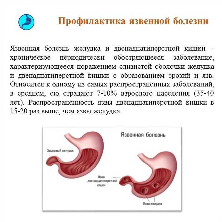 Что можно на десерт при язве желудка