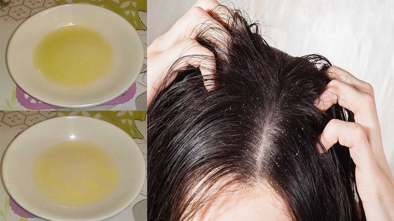 Маска для волос из яйца можно ли мыть после этого волосы шампунем