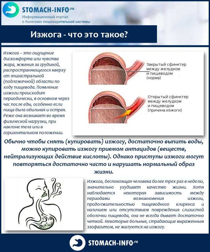Банан от изжоги: помогает ли?