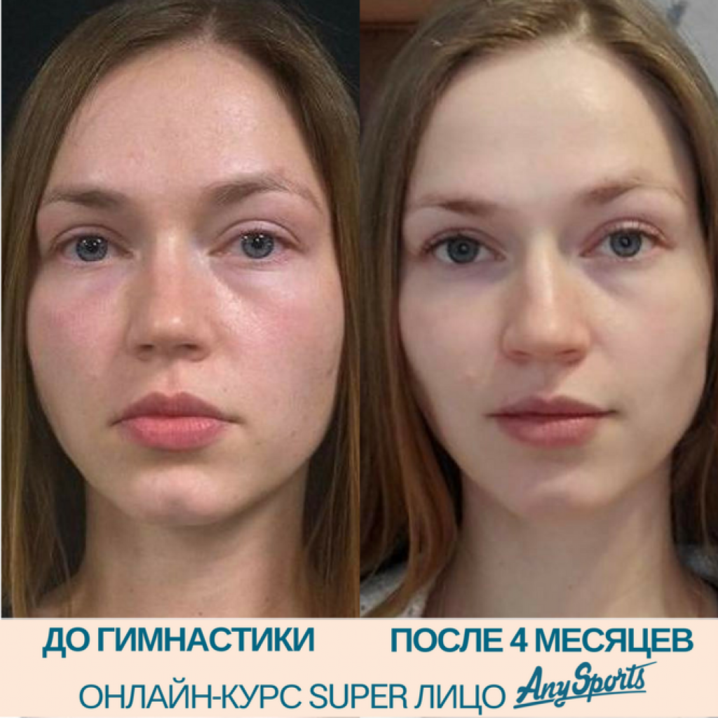 Как уменьшить объем щек