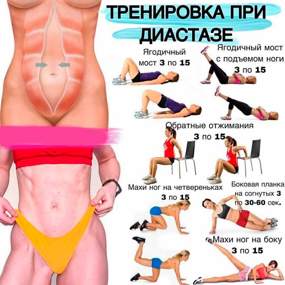 Вагинизм - причины и симптомы