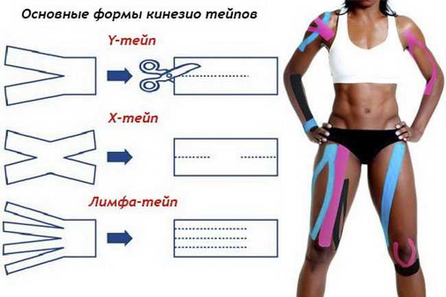 Тейпы на живот после родов схема