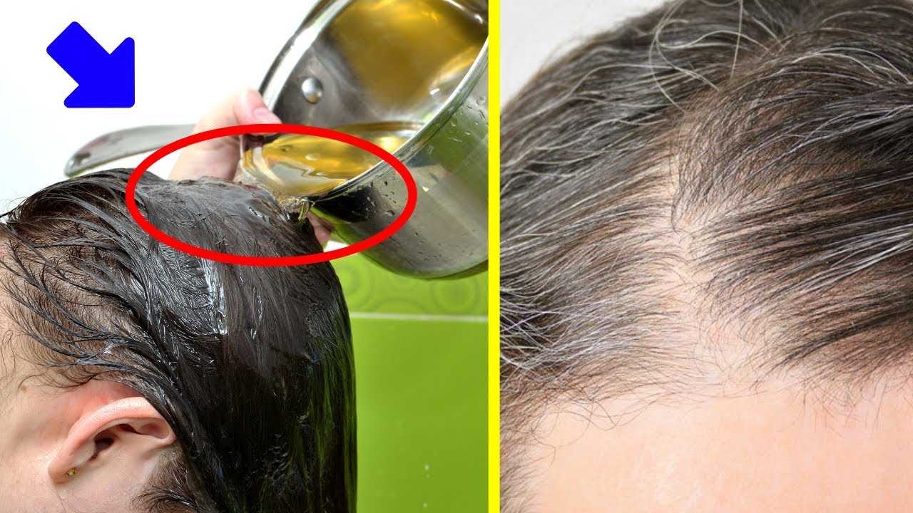 Почему седеют волосы что делать чтобы волосы не седели волосы
