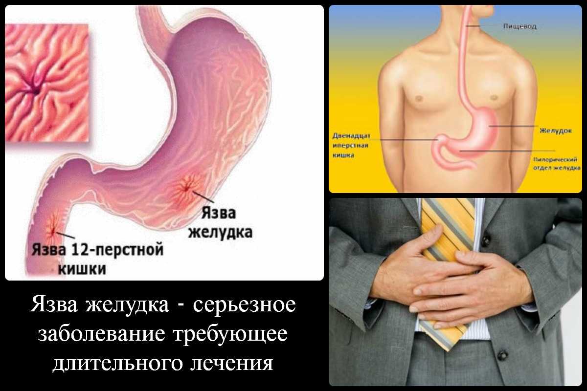 Рецепты из алоэ с мёдом для укрепления иммунитета