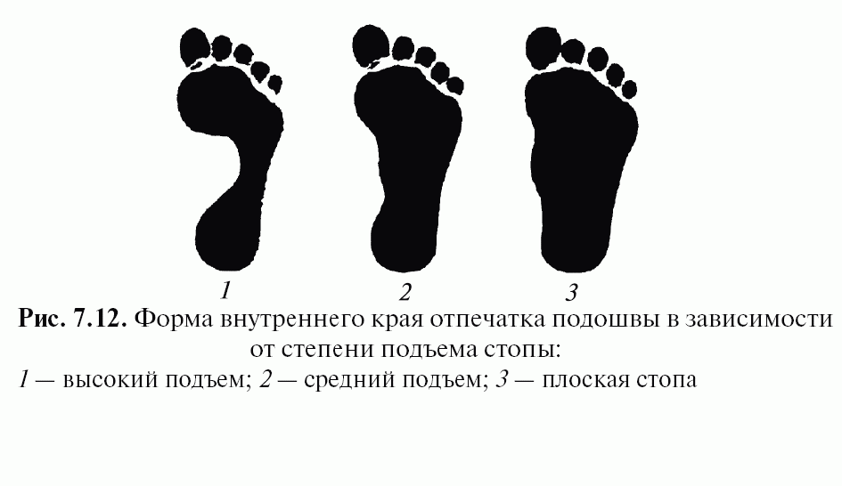 Может ли форма стопы рассказать о вашем происхождении