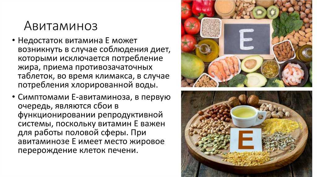 Авитаминоз: причины и основные симптомы. к какому врачу обращаться по поводу лечения авитаминоза