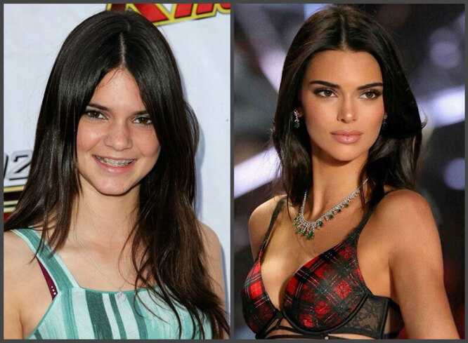 Кендалл дженнер (kendall jenner) - биография, новости, личная жизнь, фото, видео - stuki-druki.com